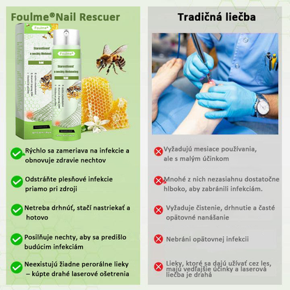 Časovo obmedzená zľava 50 % | Sprej s včelím jedom Foulme® NailRescue🐝