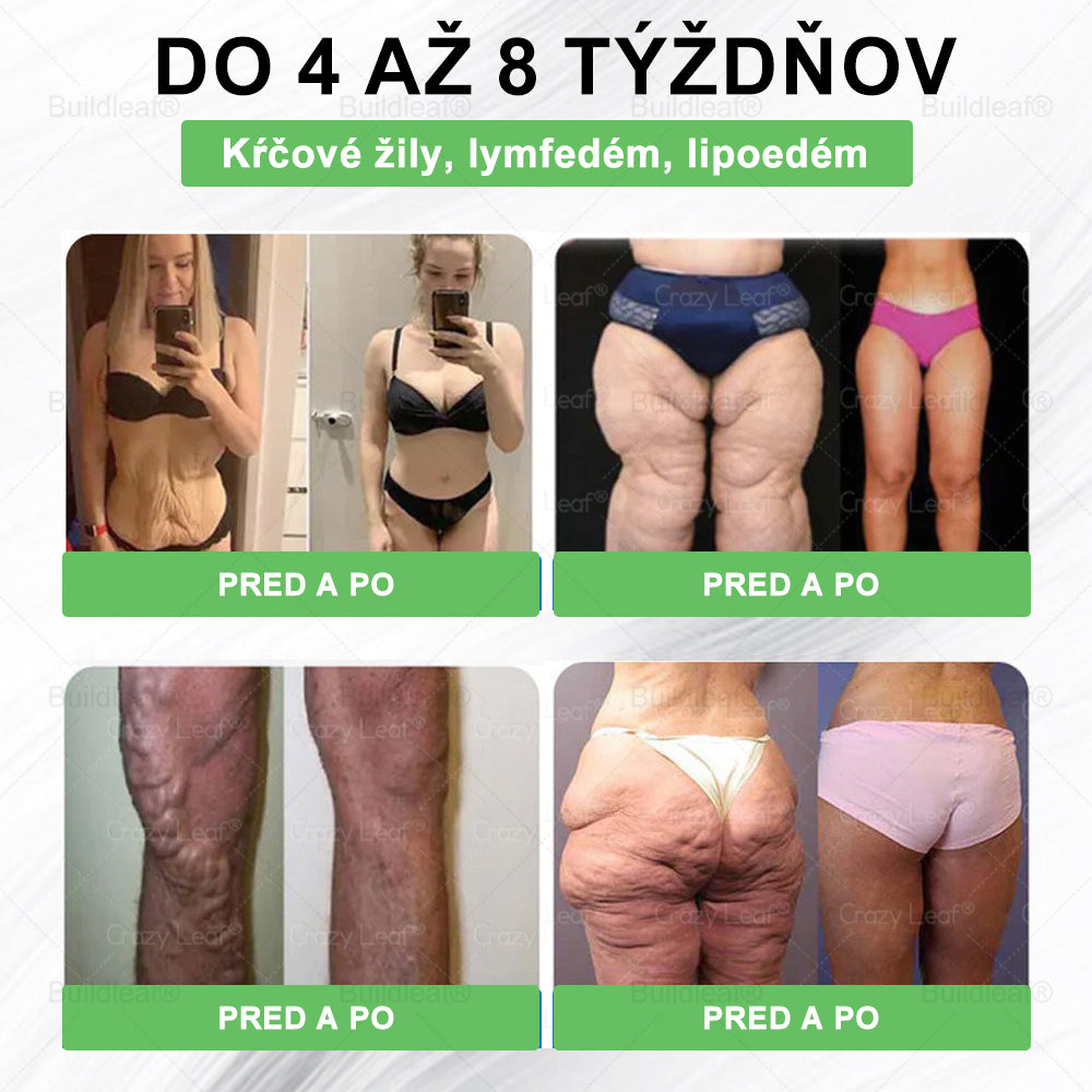 🍏🍏🍏BuildLeaf® GLP-1 6-v-1 Fit & Vital Perorálny Roztok ✅ (Len raz denne, viditeľné zmeny už za 7 dní) Pre obezitu, kardiovaskulárne ochorenia, cukrovku, spánkové apnoe, zdravie čriev, problémy s kĺbmi a ďalšie