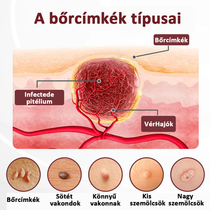 Biancat®KeraErase regeneračný krém s dvojitým účinkom