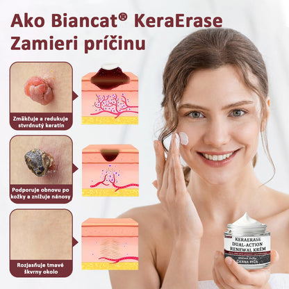 Biancat®KeraErase regeneračný krém s dvojitým účinkom