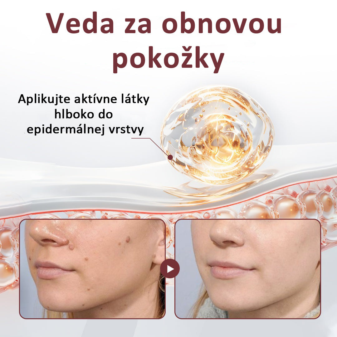 Biancat®KeraErase regeneračný krém s dvojitým účinkom