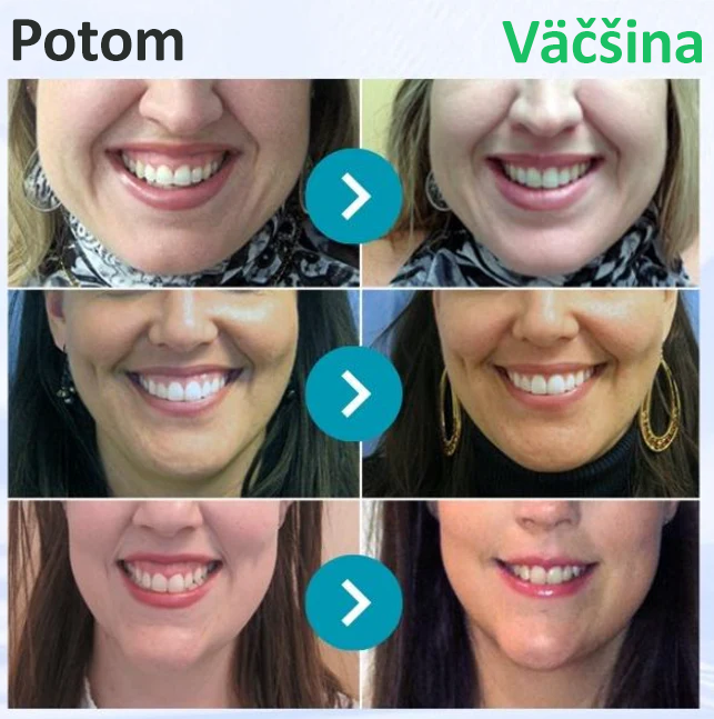 🌟Rolimey® VioCore Zubná pasta s včelím jedom