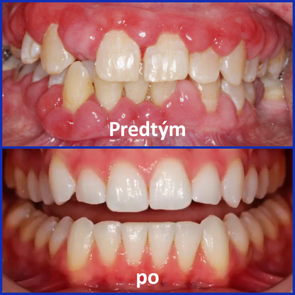 🌟Rolimey® VioCore Zubná pasta s včelím jedom